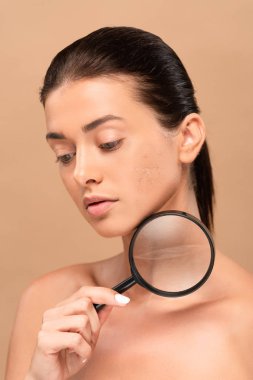naked woman with problem skin holding magnifier isolated on beige  clipart