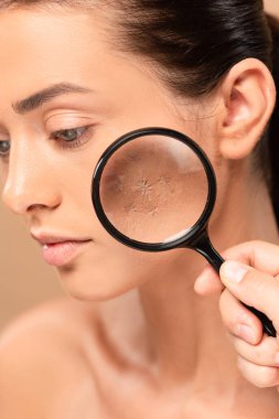 cropped view of man holding magnifier near young naked woman with problem skin isolated on beige  clipart