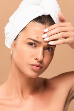 young naked woman with pimple on face touching forehead isolated on beige  clipart