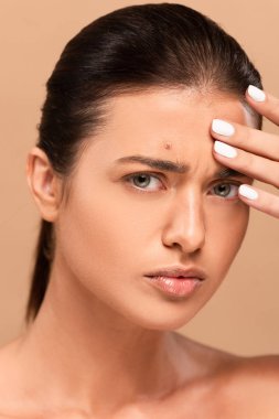naked woman with pimple on face touching forehead isolated on beige  clipart