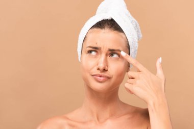 displeased woman pointing with finger at face with pimple isolated on beige  clipart