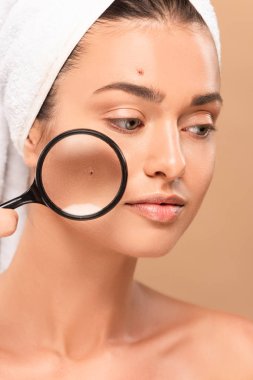 young nude woman with pimples on face holding magnifier isolated on beige  clipart