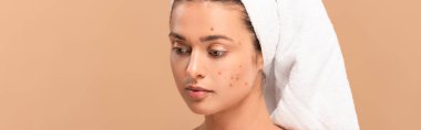 panoramic shot of girl with acne on face isolated on beige  clipart