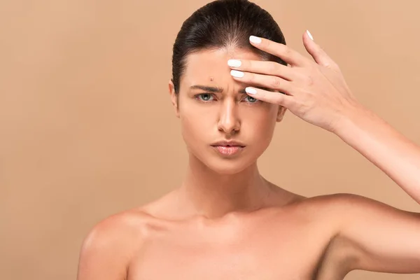 naked woman with pimple on face touching forehead isolated on beige
