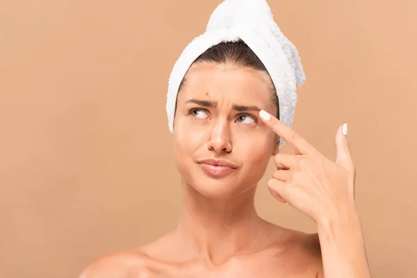 Displeased Woman Pointing Finger Face Pimple Isolated Beige — 스톡 사진