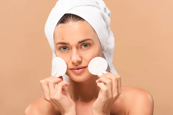 Happy Naked Woman Pimple Face Holding Cotton Pads Isolated Beige — 스톡 사진