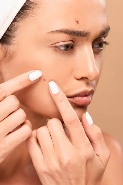 Attractive Woman Squeezing Pimples Isolated Beige — Stock Photo, Image