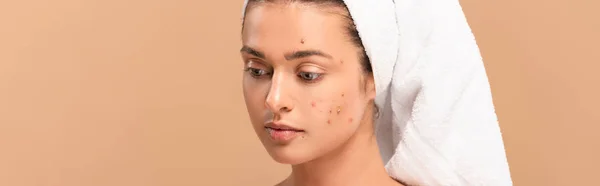 Panoramic Shot Girl Acne Face Isolated Beige — Stock Photo, Image
