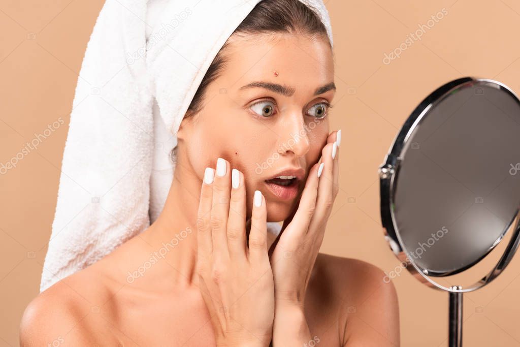 surprised naked girl touching face with pimples and looking at mirror isolated on beige 