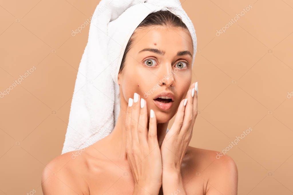 surprised naked girl touching face with pimples and looking at camera isolated on beige 