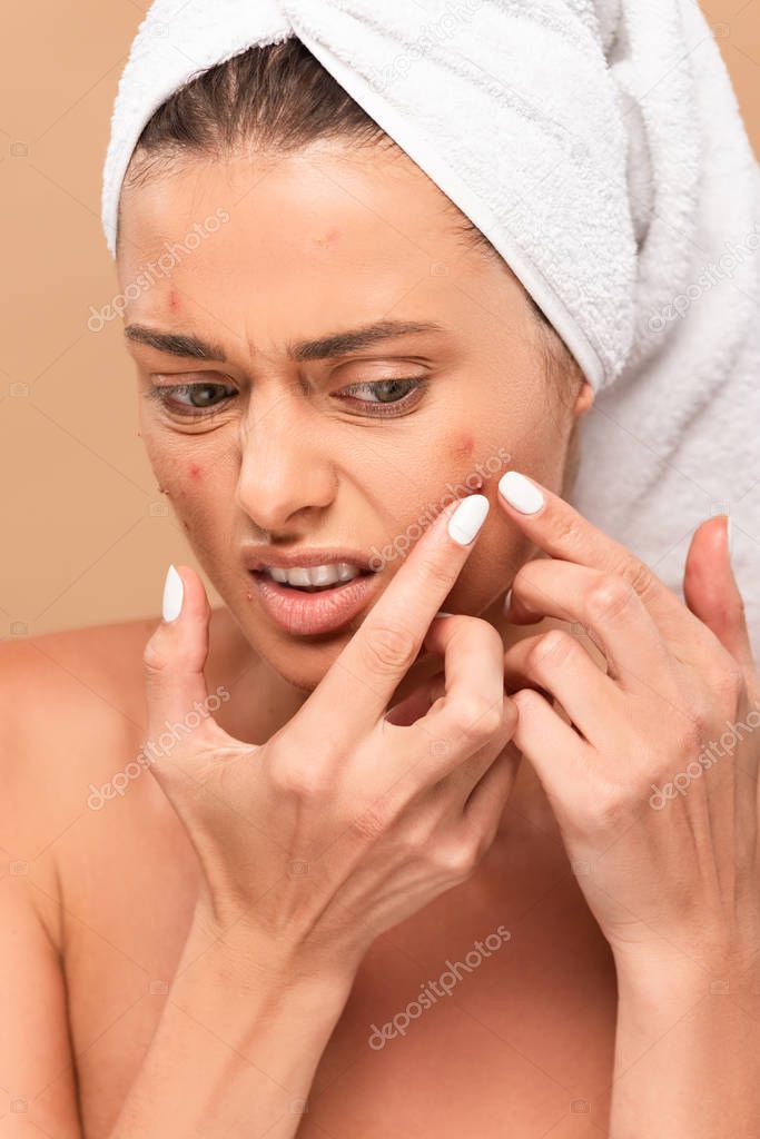 displeased girl in towel squeezing pimple isolated on beige 