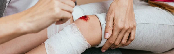 Panoramic Shot Mom Wounding Bandage Knee Daughter — 스톡 사진