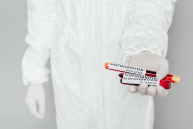 partial view of epidemiologist in hazmat suit showing test tubes with blood samples on grey background clipart