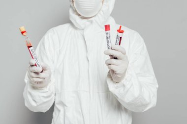 Tehlikeli madde giysisi içindeki epidemiyoloji uzmanının gri arka planda kan örnekleri olan test tüplerini tutarken kısmi görüntüsü