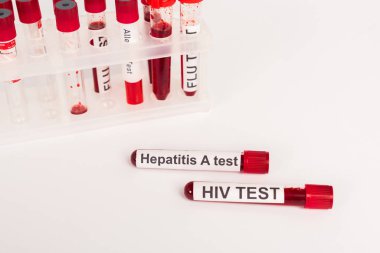 Beyaz üzerinde kan ve harf bulunan test tüpleri. 