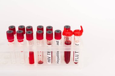 Kan örnekleri ve beyaz harflerle izole edilmiş test tüpleri. 
