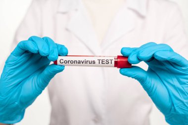 Beyaz harflerle izole edilmiş kan ve koronavirüs testi örneklerini tutan lateks eldivenli bilim adamı görüntüsü. 