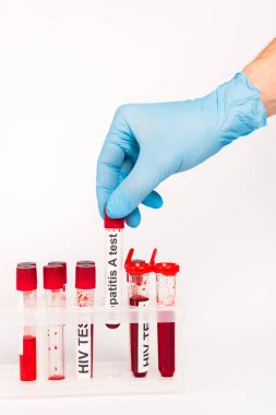 Mavi lateks eldivenli, hepatitli bilim adamının görüntüsü beyaza izole edilmiş bir test harfi. 