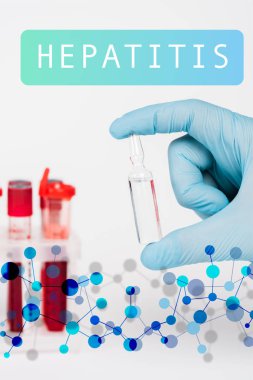 Bilim adamının cam şişeyle test tüplerinin yanında sıvı ve beyaz üzerinde hepatit harfleri olan görüntüsü. 