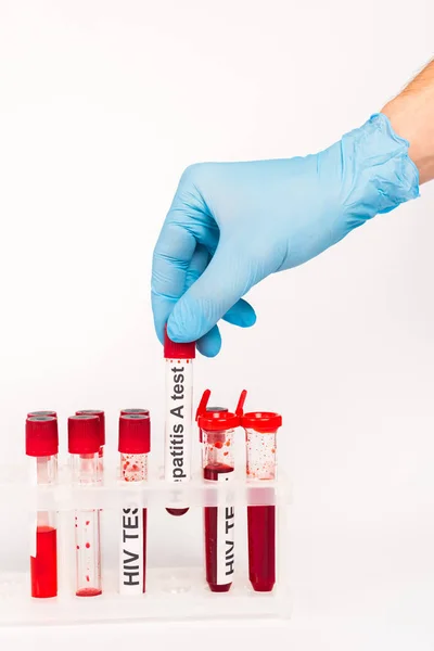 Beskärd Forskare Blå Latexhandske Innehav Prov Med Hepatit Ett Test — Stockfoto