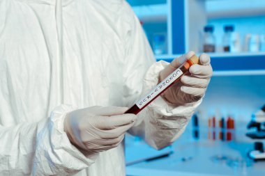 Lateks eldivenli bir bilim adamının elinde koronavirüs harfleriyle test tüpü tutarken görüntüsü. 