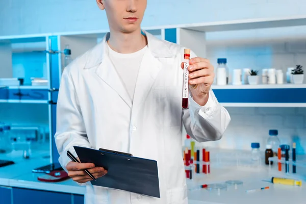 Cropped View Scientist Holding Test Tube Coronavirus Lettering Clipboard — Stock Photo, Image