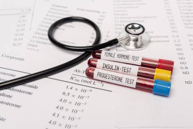 Stetoskop yakınındaki kan testleri ve hormonlu listelerin hormon ve insülin testleriyle test tüplerini kapat. 