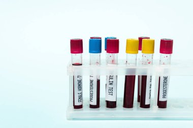 İnsülin ve hormon testleri yapılan test tüpleri mavi üzerinde izole edilmiştir.
