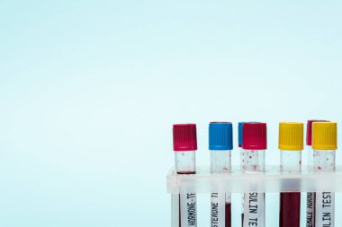 Test tubes with blood samples of hormones tests in stand isolated on blue clipart