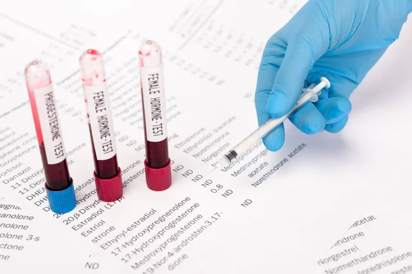 Cropped View Doctor Holding Syringe Test Tubes Blood Samples Lists — Stock Photo, Image