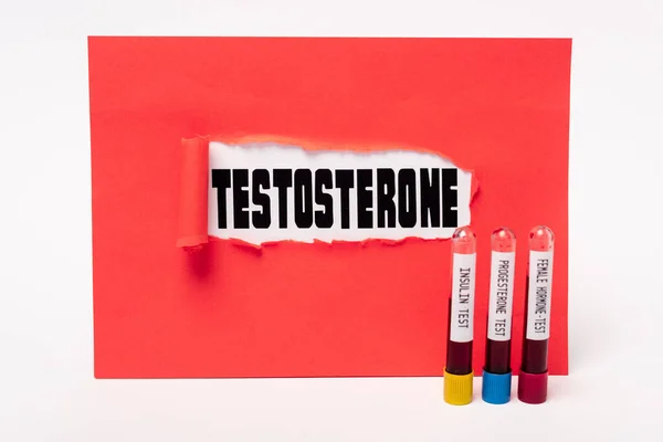 Testosteron Litere Gaura Hârtie Roșie Tuburi Testare Probe Sânge Insulină — Fotografie, imagine de stoc