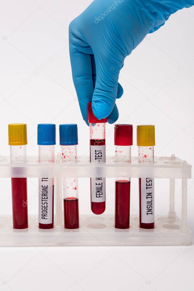 Cropped view of doctor holding test tube of female hormone test near blood samples in stand on white background