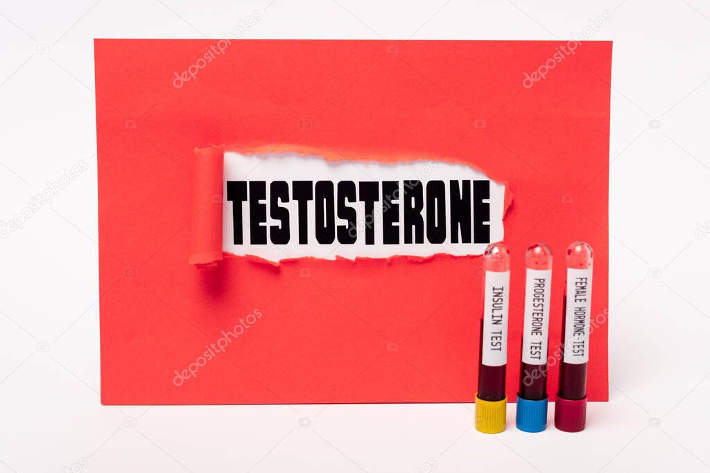 Testosterone lettering in hole of red paper and test tubes with blood samples of insulin, progesterone and female hormone tests on white background