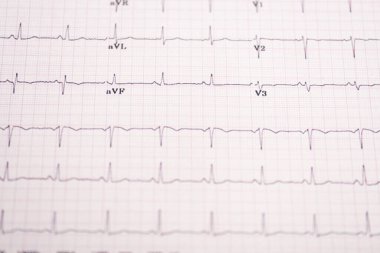 Kağıt üzerindeki elektrokardiyogramın seçici odağı