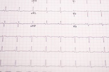 Selective focus of electrocardiogram on paper clipart