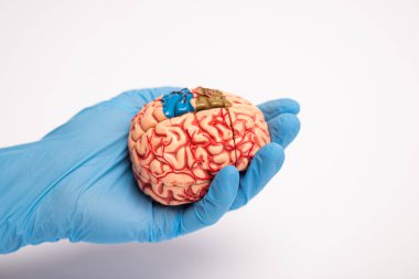 High angle view of doctor holding brain model with colored parts on white background, alzheimer disease concept  clipart