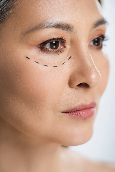 asian woman with plastic surgery lines on face isolated on grey 