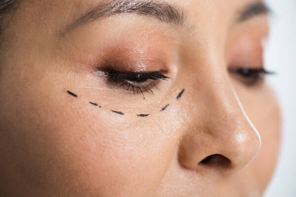 close up of asian woman with plastic surgery correction mark on face isolated on grey 