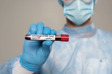 Doktorun elinde test tüpü ve gri üzerinde negatif koronavirüs testi olan bir tüp tuttuğunu gördüm.