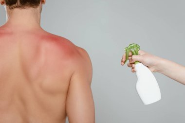 Cropped view of woman applying spray on male back with redness isolated on grey clipart