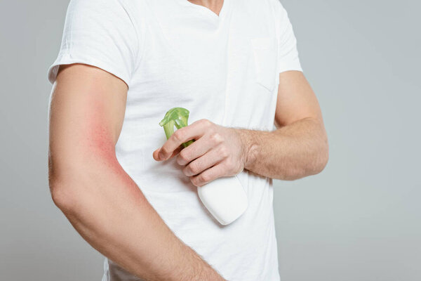 Обрезанный вид человека с аллергией на руку с помощью спрея, изолированного на сером

