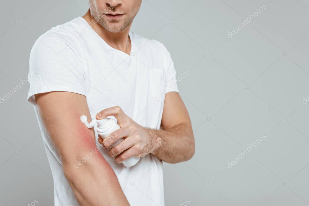Cropped view of man applying foam on hand with allergy isolated on grey