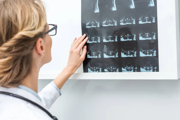 Doctor pegando escaneo de rayos X a la lámpara - foto de stock