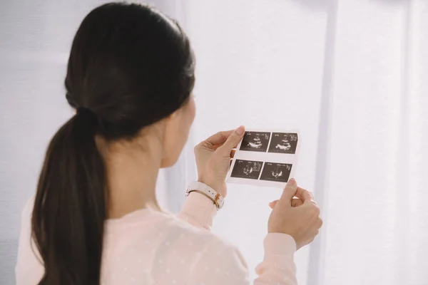 Mujer embarazada mirando la foto de los diagnósticos de ultrasonido - foto de stock