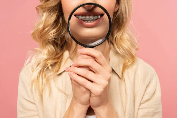 Cropped view of woman with dental braces holding magnifying glass isolated on pink — Stock Photo