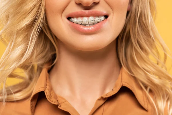 Vue recadrée de la femme souriante dans des appareils dentaires isolés sur jaune — Photo de stock