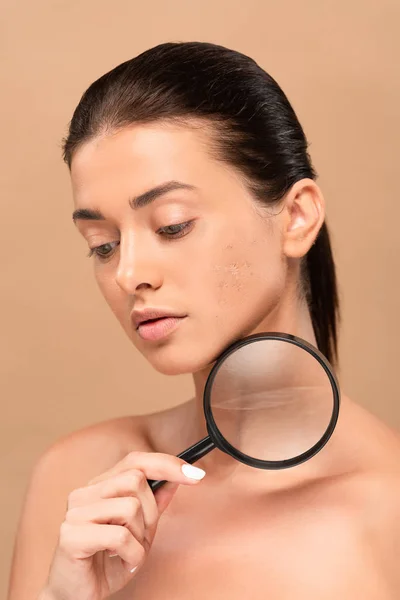 Mulher nua com problema de pele segurando lupa isolada no bege — Fotografia de Stock