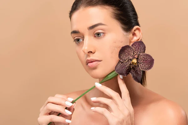 Nackte Frau mit Problemhaut hält Orchidee nahe Gesicht isoliert auf beige — Stockfoto