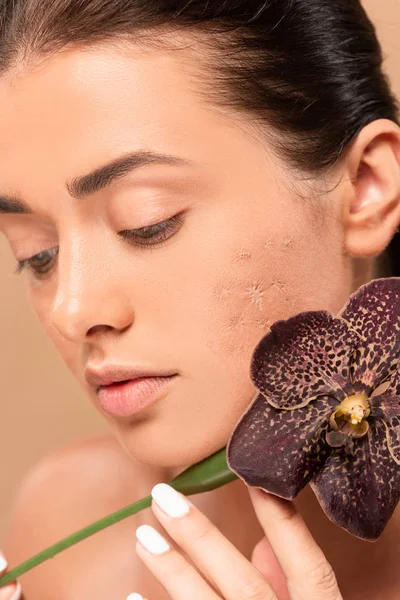 Жінка з проблемною шкірою, що тримає орхідею біля обличчя ізольована на бежевому — стокове фото