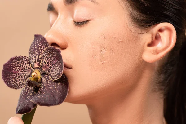 Joven mujer con problema piel oliendo orquídea aislado en beige - foto de stock